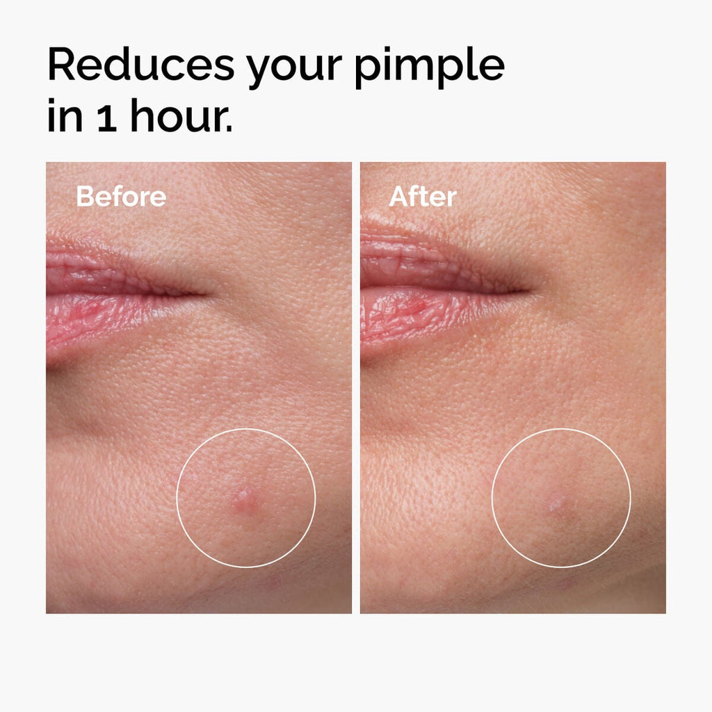 Sulfur 10% Powder-to-Cream Concentrate Targeted Serum Care